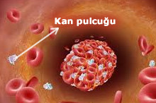 kan pulcuğu