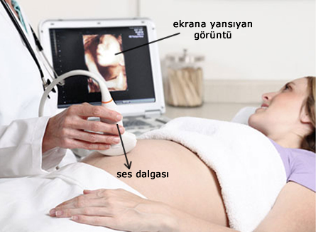 ultrason-cigazi